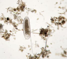 NanoSight customer~ Melissa R. – Florida, USA